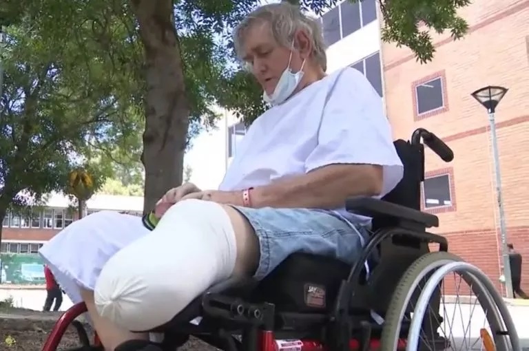Australian Harold Molle had to have his left leg amputated after Covid Vax