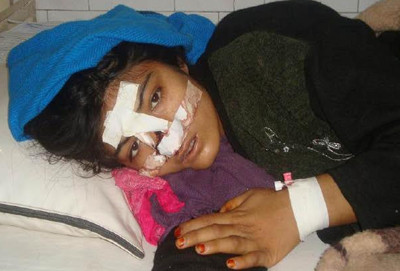 Young afghan girl victim of domestic violence