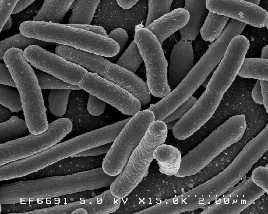 E-coli-NIH